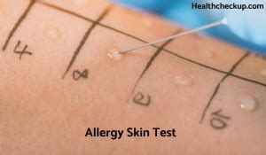 Allergy Skin Test: Purpose, Procedure & Results .